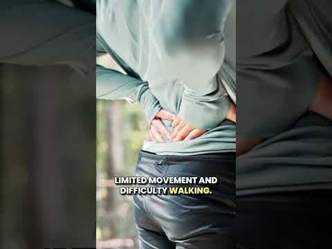 Hip Dislocation: Know the Treatment Options