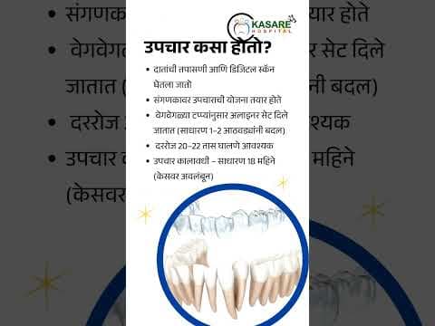 Benefits of Invisalign