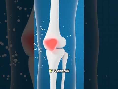 Meniscal Cyst