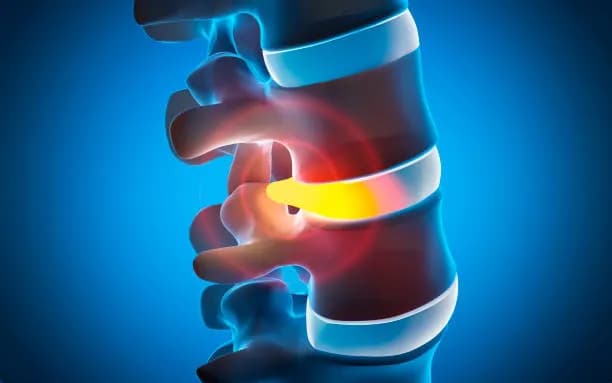 Spine Surgery